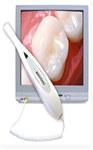 Digital Intra-Oral Camera 