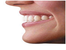 Invisalign® and Clear Aligner® 