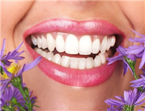 Cosmetic dental bonding